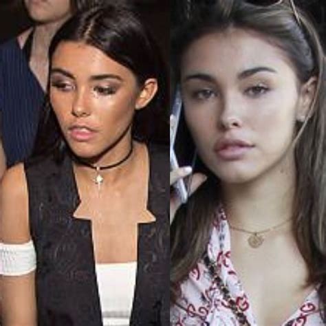 madison beer before plastic|Madison Beer shows “proof” she didn’t have plastic ...